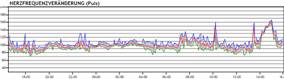 HRV-wissenschaft HRV-Wissenschaft