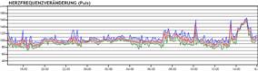 HRV-Wissenschaft